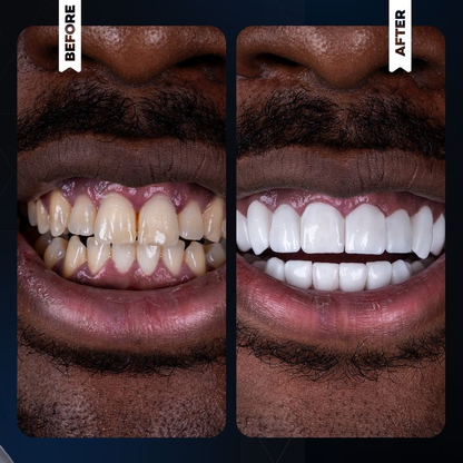 Dentifrice Blanchissant Anti-Plaque & Anti-Caries 🌟