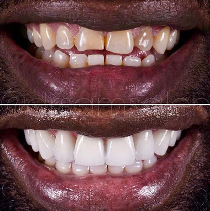 Dentifrice Blanchissant Anti-Plaque & Anti-Caries 🌟