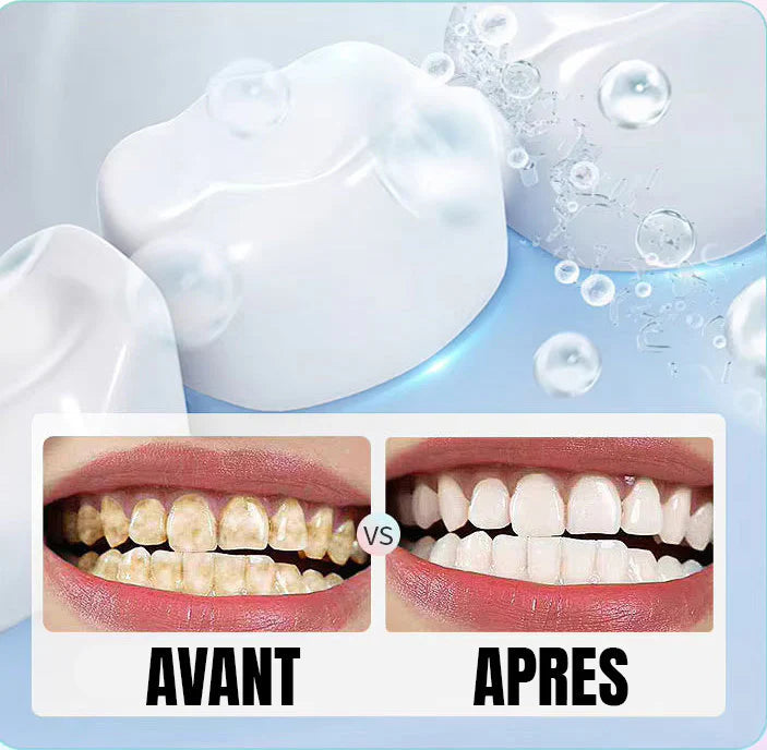 Dentifrice Blanchissant Anti-Plaque & Anti-Caries 🌟