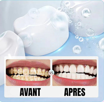 Dentifrice Blanchissant Anti-Plaque & Anti-Caries 🌟